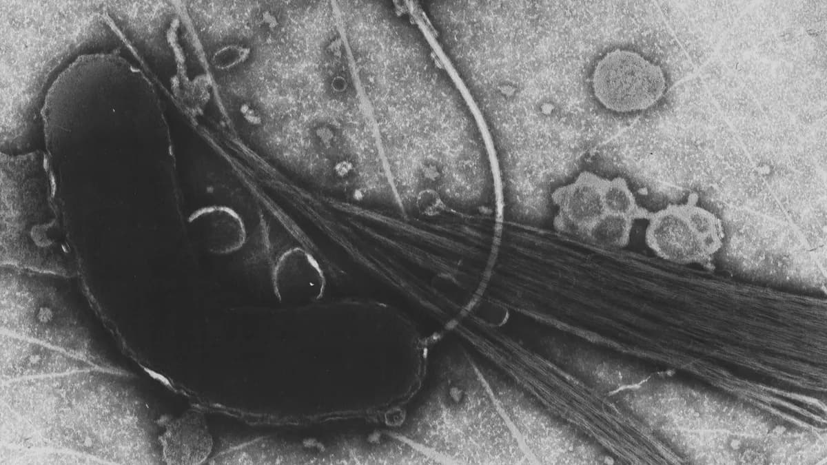 Ilustracija: bakterija Vibrio cholerae, uzročnik kolere, snimljena elektronskim mikroskopom.
